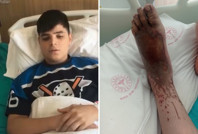 Ailesine maddi destek için tarlaya gidiyordu: Az kalsın ayaklarından olacaktı