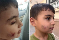 Evde uyuyan çocuğu lağım faresi ısırdı