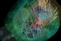 Tarihte bir ilk: Beynin 'karar anı'nın haritasını çıkardılar