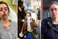 Yanlış alarm mağdur etti: Otomobil kapısı silah sayıldı