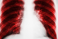 Akciğer hastalarının dikkatine: Bu üç şarkıyı söylemek iyi geliyor