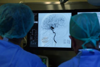 Beyin sarsıntısı geçiren yaşlılarda büyük tehlike