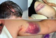 Beyzbol sopasıyla döven dayısı serbest bırakılınca isyan etti