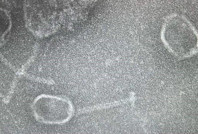 Kıbrıs’tan çıktı: Yeni virüs “Alasiavirus” keşfedildi