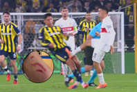 Fenerbahçe-Stuttgart maçında Edson Alvarez'e acımasız faul