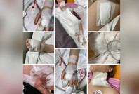 Uzaklaştırma talebi yetmedi... Eski kocası tarafından 11 yerinden bıçaklandı