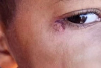 Vahşet: Öğrencinin yüzünde sigara söndürüldüğü iddiasına tutuklama