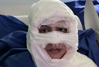 Kadıköy'de dehşete düşüren olay: Genç kadını yaktı