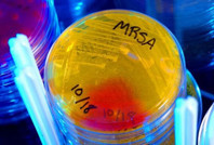 Tıp dünyasını heyecanlandıran 'tesadüfi' keşif: Dirençli bakterilere karşı 100 kat daha etkili