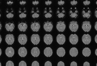 Zihin okumada çığır açacak keşif: Beyindeki görüntüleri cümlelere dönüştürdüler