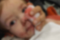 İki çocuk köpek saldırısında yaralandı