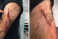 Öğretmene sokak ortasında jiletli saldırı