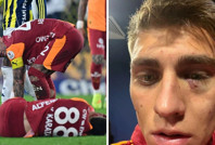 Galatasaray, Kazımcan'ın gözünün son halini paylaştı