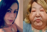 Dolgu yaptırmak istedi, hayatı karardı: Madeni yağ çıktı