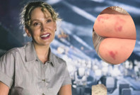 Farah Zeynep Abdullah’ın morlukları hayranlarını endişelendirdi