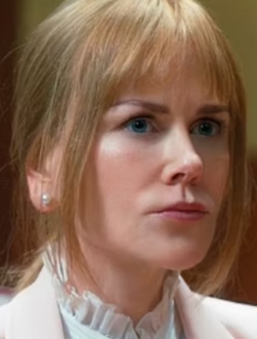 Nicole Kidman'ın yüzündeki hayranlarını korkutan detay - Resim : 1