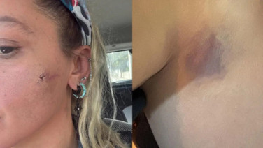 Yıldız Asyalı: Kocam tarafından darp edildim