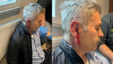 Önce işten çıkardılar sonra çağırıp dövdüler