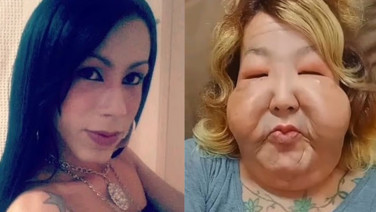 Dolgu yaptırmak istedi, hayatı karardı: Madeni yağ çıktı