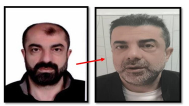 Ameliyatla kardeşine benzedi, 7 yıl kaçtı