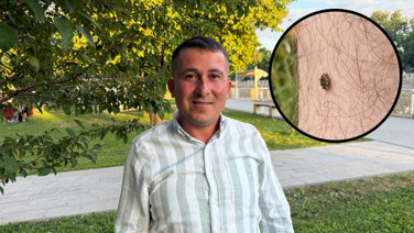 Bacağında keneyle nişana gitti