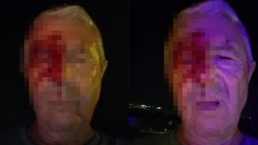 Haber yaparken saldırıya uğrayan muhabir yaralandı