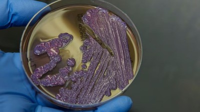 Melioidoz salgınında 20 kişi öldü