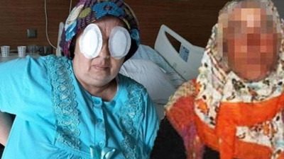 Şizofren kadın, yatağa bağımlı hastanın gözlerini 29 saniyede oydu