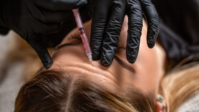 Botoks 15 yaşa düştü, uzman isim uyardı: Kişilik bozukluğuna dönüşüyor