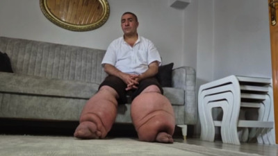 15 yıl önce yüksek ateşle hastaneye gitti, hayatı altüst oldu