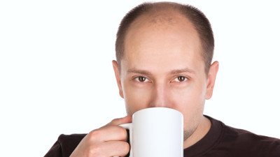 Bilimsel araştırma: Şekerli içecekler kelliğe sebep oluyor