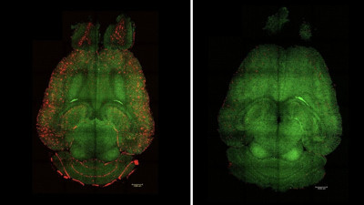Alzheimer tedavisinde tarihi adım: Farelerde başarı elde ettiler