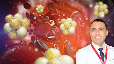 Kolesterol sessiz bir düşman: Damarlarınız tıkanmadan önlem alın
