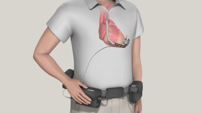 Sağlık skandalı: Hastaneler ölüm riskini artıran kalp cihazı kullandı