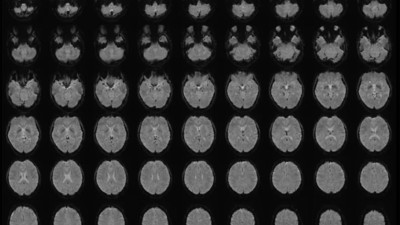 Zihin okumada çığır açacak keşif: Beyindeki görüntüleri cümlelere dönüştürdüler