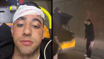Tünelde taksici dehşeti: Sopayla kafasına defalarca vurdu
