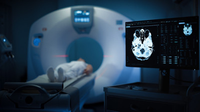 WHO’dan çarpıcı rapor: Her 10 kanser vakasından 4’ü önlenebilir