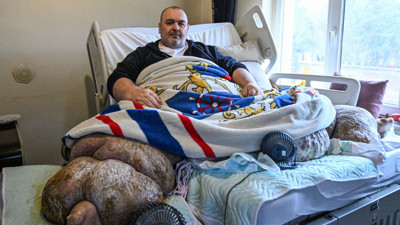 Duvarlar kırıldı, 30 kişi taşıdı: 300 kiloya ulaşan fil hastası Ankara'ya gönderildi