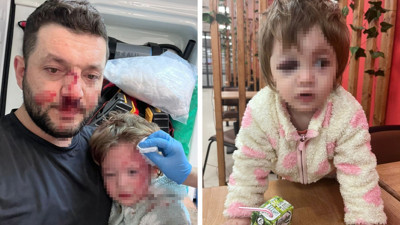 Kafatası çatlayan minik İkra taburcu edildi