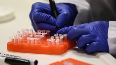 M çiçeği salgını: 8 kişi öldü