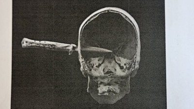 Almanya'yı sarsan cinayet: Nişanlısını dövdü, kuzeninin kafasına bıçak sapladı