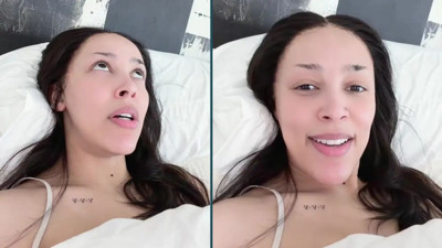 Doja Cat hastalığını açıkladı: Yıllardır mücadele ediyorum