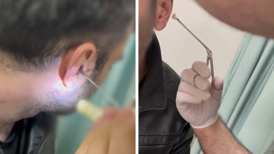 Uyuşturucuyu sakladığı yer şaşkına çevirdi