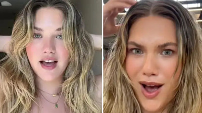 Popüler sosyal medya akımı saç dökülmesine yol açıyor