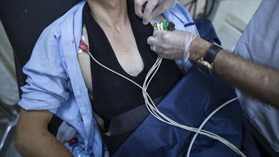 Kardiyoloji uzmanından kritik uyarı: 30 yaş üstü dikkat!