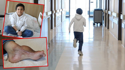 Kasığından alınan doku ayağına nakledildi, yeniden koşmaya başladı