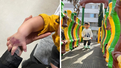 Tomografi çektirdi, 3 günde 2 ameliyat oldu