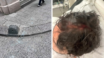 Beyoğlu’nda kaldırımda yürürken başına cam düştü, 7 dikiş atıldı