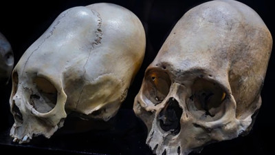 'Koni kafa' mumyaların DNA analizinde büyük sır