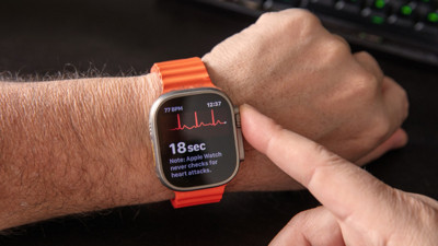 Bu Apple Watch'lara güncelleme gelmeyecek